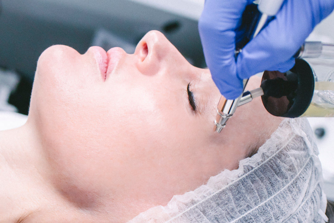 Microdermabrasion and Oxygen Infusion Facial